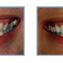 Craig Sater DDS - Cosmetic Dentistry