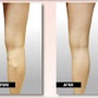 USA Vein Clinics