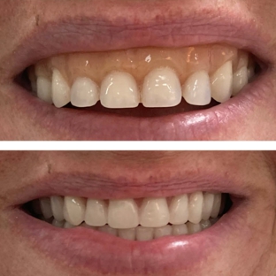 Shyne Dental & Denture Clinic - Bell Park, VIC