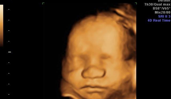 You are my Sunshine 3D/4D Ultrasound & Photography - Enid, OK