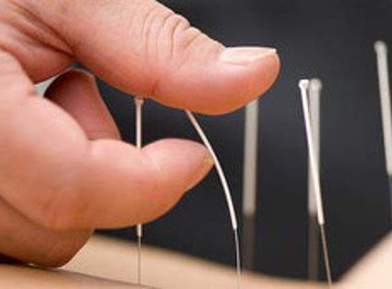 Springer Acupuncture - Tallahassee, FL