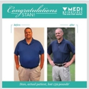 MEDI Weightloss - Weight Control Services