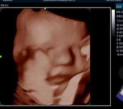 (Arlington) Baby Bee 3D Ultrasound + Studio - Arlington, TX