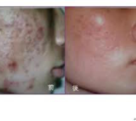 Jeunesse Skin Rejuvenation Distributor - Groveland, FL