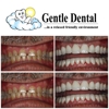 Gentle Dental gallery