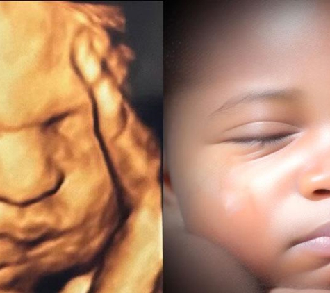 Chubby Cheeks Ultrasound Studio of Kernersville - Kernersville, NC