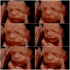 Hello Baby! 4D Ultrasound Studio gallery