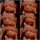 Hello Baby! 4D Ultrasound Studio