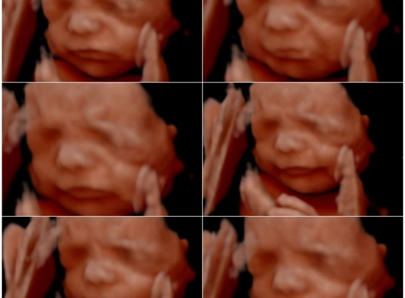 Hello Baby! 4D Ultrasound Studio - Fayetteville, AR