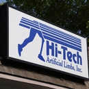 Hi-Tech Artificial Limbs - Prosthetic Devices