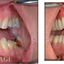 Leslie B. Anthony, DMD - Implant Dentistry