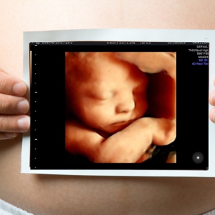 Miracle in motion ultrasound and reproductive center in Muncie - Muncie, IN