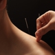 Cochise Acupuncture