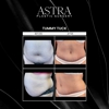 Astra Plastic Surgery - Alpharetta gallery