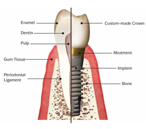 Yamanto Dental Surgery - Yamanto, QLD