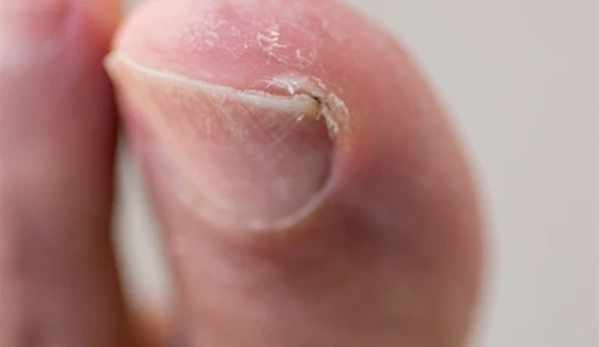 Silver Podiatry - Inglewood, WA