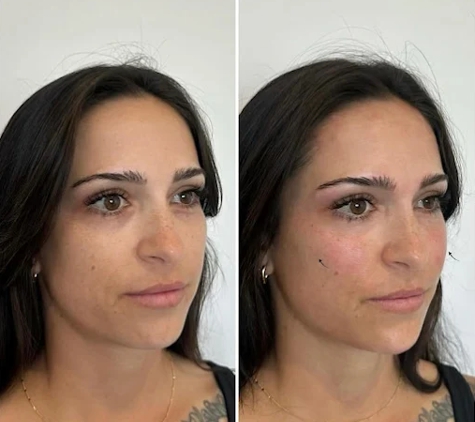 BeautyFULL Cosmetic Medical Clinic - Kingscliff, NSW