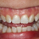 Fusion Dental Care - Dental Clinics