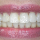 Enhanced Smiles - Dental Hygienists