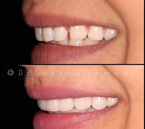 Dr. Borzoo Ahmadi DDS - West Hollywood, CA