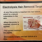 Brenda Kashella Electrolysis Medical & Cosmetic