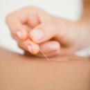 Healing Spring Acupuncture Center - Acupuncture