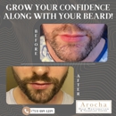 Arocha Hair Restoration