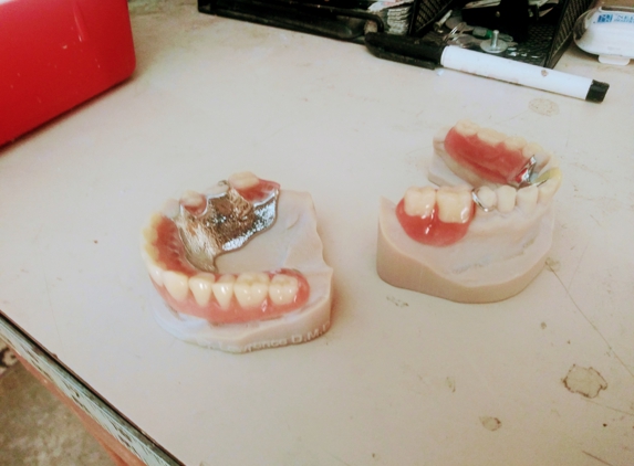 All good Dental Pros Laboratory - Las Vegas, NV. 3d printed models