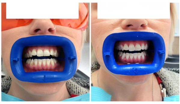 Smile Care Dentists - Geelong, VIC