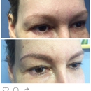 Brows Beauty and Bronze - Hair Removal