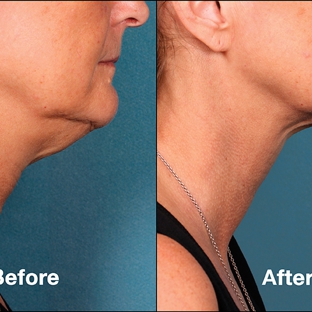 Graper Cosmetic Surgery - Charlotte, NC