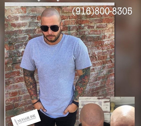 NuHair Ink. Scalp Micro Pigmentation - Roseville, CA