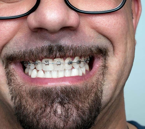 E Orthodontics - Doncaster East, VIC