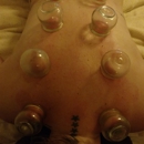 Balance Acupuncture - Acupuncture