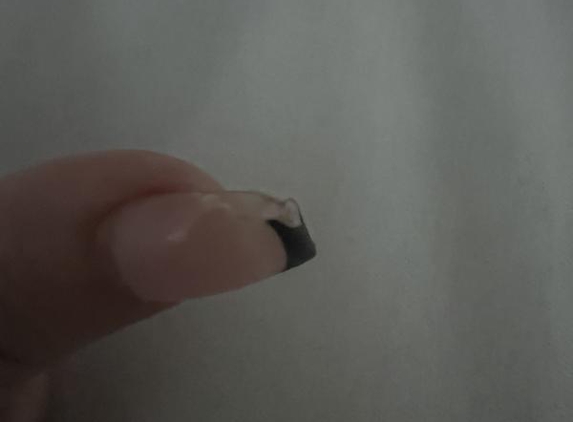 Northern Star Nails - Mona Vale, NSW. 1 of 3 that had this happen
