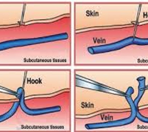 South Coast Skin & Vein Clinic - Wollongong, NSW