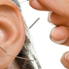 Michael L Miller L.ac Acupuncture gallery