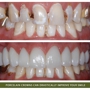 Boulder County Smiles - Aesthetic & General Dentistry