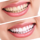 Stacy Smiles - Teeth Whitening Products & Services