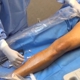 San Francisco Vein Center - Melinda L Aquino MD