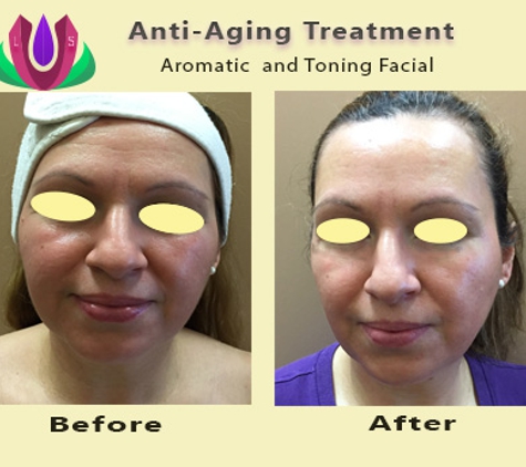 Luminescent Skin by Tina T - Los Gatos, CA. Anti-Aging Treatment