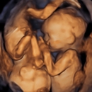 Your 4D Baby - Medical Imaging Services