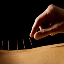 Acupuncture-Massage For Pain - Massage Services
