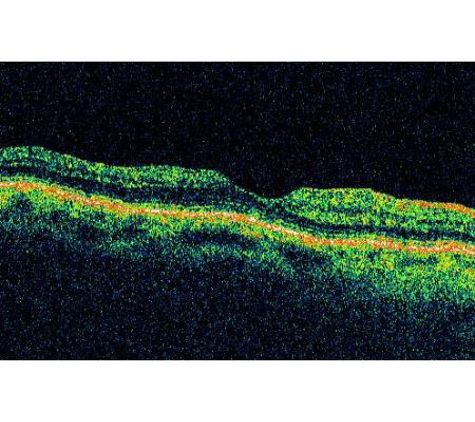 Sydney Retina Clinic & Day Surgery - Sydney, NSW