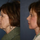 Smith Cosmetic Surgery & Medical Aesthetic Center - Physicians & Surgeons, Plastic & Reconstructive