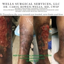 Wells Surgical Services LLC - Wound Care