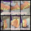 Athill's Denture Cleaning & Repair gallery