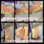 Athill's Denture Cleaning & Repair