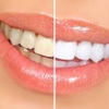 Tera L. DePaoli - Cosmetic Dentist & Dental Implant Gibsonia PA gallery