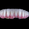 Next Smile + Implant gallery